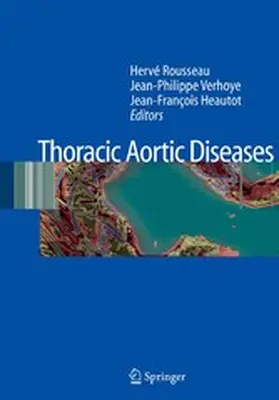 Rousseau / Verhoye / Heautot |  Thoracic Aortic Diseases | eBook | Sack Fachmedien
