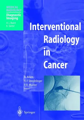 Adam / Mueller / Dondelinger |  Interventional Radiology in Cancer | Buch |  Sack Fachmedien