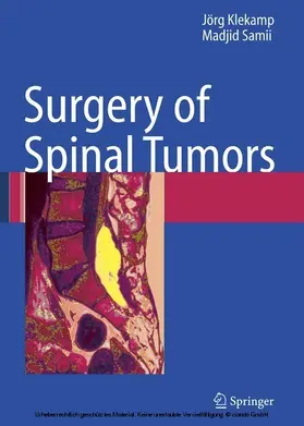 Klekamp / Samii |  Surgery of Spinal Tumors | eBook | Sack Fachmedien