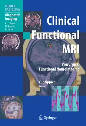 Stippich |  Clinical Functional MRI | eBook | Sack Fachmedien