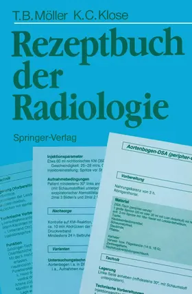 Möller / Klose |  Rezeptbuch der Radiologie | Buch |  Sack Fachmedien
