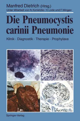Dietrich |  Die Pneumocystis carinii Pneumonie | Buch |  Sack Fachmedien