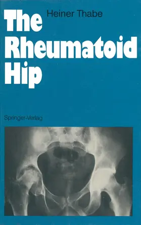 Thabe |  The Rheumatoid Hip | Buch |  Sack Fachmedien