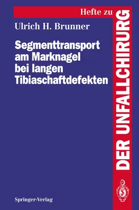 Brunner |  Segmenttransport am Marknagel bei langen Tibiaschaftdefekten | Buch |  Sack Fachmedien