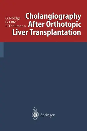 Nöldge / Otto / Theilmann |  Cholangiography After Orthotopic Liver Transplantation | Buch |  Sack Fachmedien