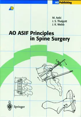 Thalgott / Aebi / Webb |  AO ASIF Principles in Spine Surgery | Buch |  Sack Fachmedien