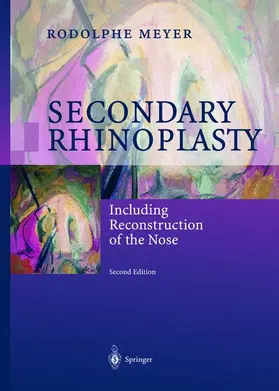 Meyer | Secondary Rhinoplasty | Buch | 978-3-540-65884-9 | sack.de