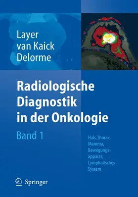 Layer / Delorme / Kaick |  Radiologische Diagnostik in der Onkologie | Buch |  Sack Fachmedien