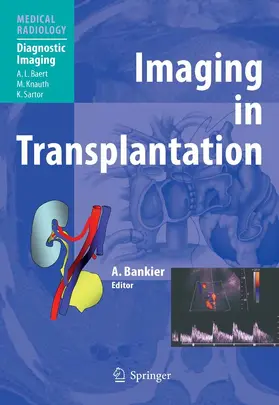 Bankier |  Imaging in Transplantation | eBook | Sack Fachmedien