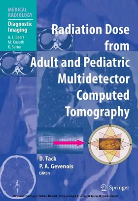 Tack / Gevenois |  Radiation Dose from Adult and Pediatric Multidetector Computed Tomography | eBook | Sack Fachmedien