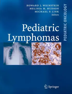 Weinstein / Hudson / Link | Pediatric Lymphomas | E-Book | www2.sack.de