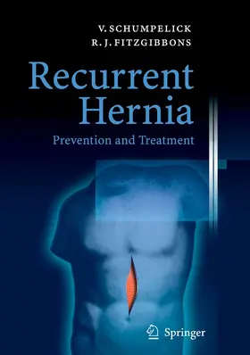Schumpelick / Fitzgibbons |  Recurrent Hernia | eBook | Sack Fachmedien