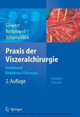 Rothmund / Schumpelick |  Praxis der Viszeralchirurgie | eBook | Sack Fachmedien