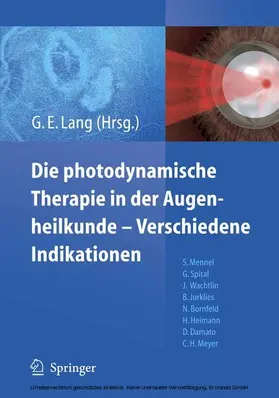 Lang |  Die photodynamische Therapie in der Augenheilkunde - Verschiedene Indikationen | eBook | Sack Fachmedien