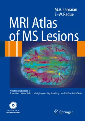 Sahraian / Radü | MRI Atlas of MS Lesions | E-Book | www2.sack.de