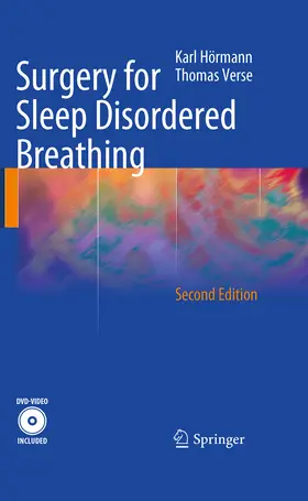 Hörmann / Verse |  Surgery for Sleep Disordered Breathing | eBook | Sack Fachmedien