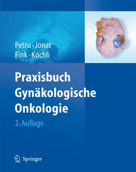 Petru / Jonat / Fink |  Praxisbuch Gynäkologische Onkologie | eBook | Sack Fachmedien