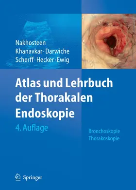 Nakhosteen / Darwiche / Khanavkar |  Atlas und Lehrbuch der Thorakalen Endoskopie | eBook | Sack Fachmedien
