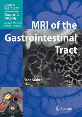 Stoker | MRI of the Gastrointestinal Tract | Buch | 978-3-540-85531-6 | sack.de