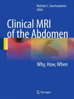 Gourtsoyiannis |  Clinical MRI of the Abdomen | Buch |  Sack Fachmedien