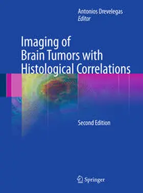 Drevelegas |  Imaging of Brain Tumors with Histological Correlations | Buch |  Sack Fachmedien