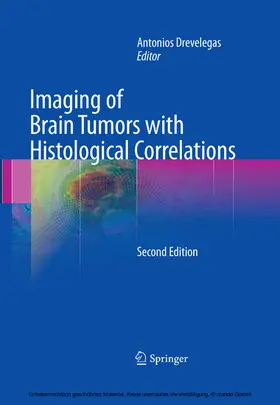Drevelegas |  Imaging of Brain Tumors with Histological Correlations | eBook | Sack Fachmedien
