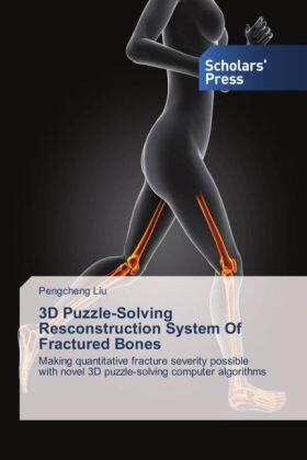 Liu |  3D Puzzle-Solving Resconstruction System Of Fractured Bones | Buch |  Sack Fachmedien