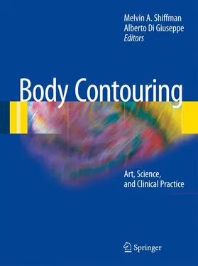 Di Giuseppe / Shiffman |  Body Contouring | Buch |  Sack Fachmedien