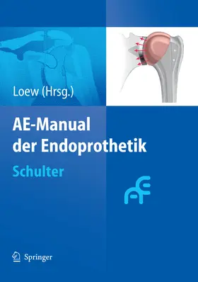 Loew | AE-Manual der Endoprothetik | E-Book | sack.de