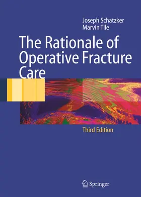 Schatzker / Tile |  The Rationale of Operative Fracture Care | Buch |  Sack Fachmedien