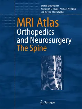 Weyreuther / Heyde / Weber |  MRI Atlas | Buch |  Sack Fachmedien