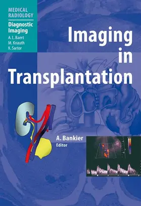 Bankier |  Imaging in Transplantation | Buch |  Sack Fachmedien