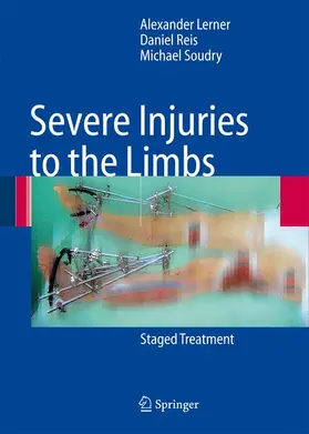 Lerner / Soudry / Reis |  Severe Injuries to the Limbs | Buch |  Sack Fachmedien