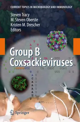 Tracy / Drescher / Oberste |  Group B Coxsackieviruses | Buch |  Sack Fachmedien