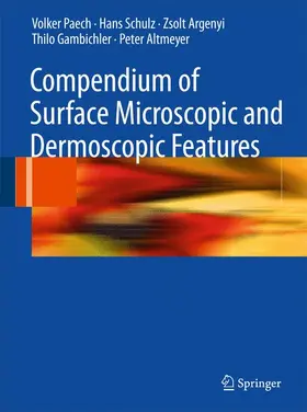 Paech / Schulz / Argenyi | Compendium of Surface Microscopic and Dermoscopic Features | Buch | 978-3-642-09774-4 | sack.de