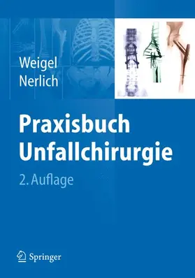 Weigel / Nerlich |  Praxisbuch Unfallchirurgie | Buch |  Sack Fachmedien