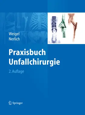Weigel / Nerlich | Praxisbuch Unfallchirurgie | E-Book | sack.de
