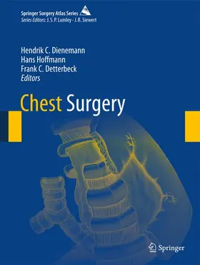 Dienemann / Detterbeck / Hoffmann |  Chest Surgery | Buch |  Sack Fachmedien