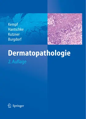 Kempf / Hantschke / Kutzner |  Dermatopathologie | eBook | Sack Fachmedien