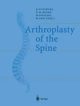 Gunzburg / Mayer / Szpalski |  Arthroplasty of the Spine | eBook | Sack Fachmedien