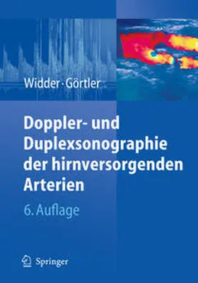 Widder / Görtler |  Doppler- und Duplexsonographie der hirnversorgenden Arterien | eBook | Sack Fachmedien