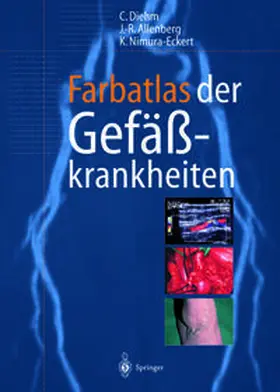 Diehm / Allenberg / Nimura-Eckert |  Farbatlas der Gefäßkrankheiten | eBook | Sack Fachmedien