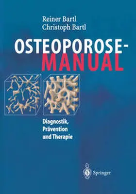 Bartl |  Osteoporose-Manual | eBook | Sack Fachmedien