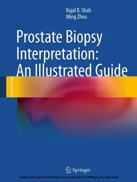 Shah / Zhou |  Prostate Biopsy Interpretation: An Illustrated Guide | eBook | Sack Fachmedien