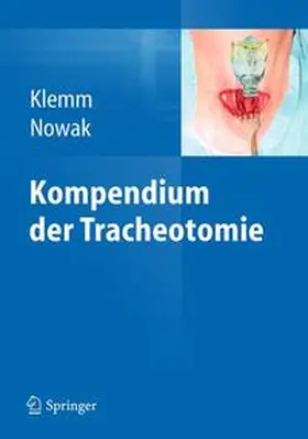 Klemm / Nowak | Kompendium der Tracheotomie | Buch | 978-3-642-22644-1 | www2.sack.de