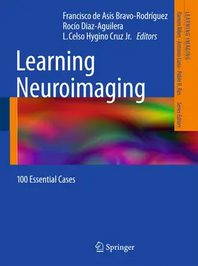 Bravo-Rodríguez / Diaz-Aguilera / Hygino da Cruz Jr. |  Learning Neuroimaging | Buch |  Sack Fachmedien