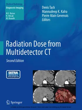 Tack / Kalra / Gevenois |  Radiation Dose from Multidetector CT | eBook | Sack Fachmedien