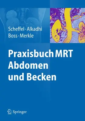 Scheffel / Alkadhi / Boss |  Praxisbuch MRT Abdomen und Becken | Buch |  Sack Fachmedien