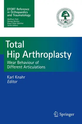 Knahr |  Total Hip Arthroplasty | eBook | Sack Fachmedien