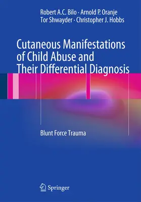 Bilo / Hobbs / Oranje |  Cutaneous Manifestations of Child Abuse and Their Differential Diagnosis | Buch |  Sack Fachmedien
